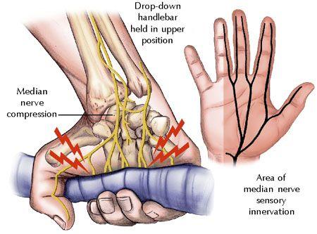 Comparing the effect of trigger shifters vs. grip shifters, trigger shifters are better for experienced riders and can alleviate pressure on the wrist area.